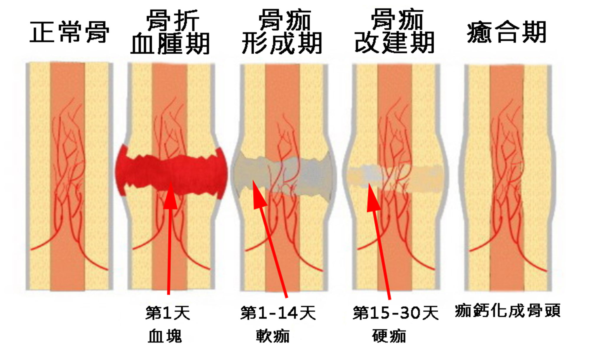 其他彙整 熱河診所 高雄骨科 高雄醫美 高雄植髪